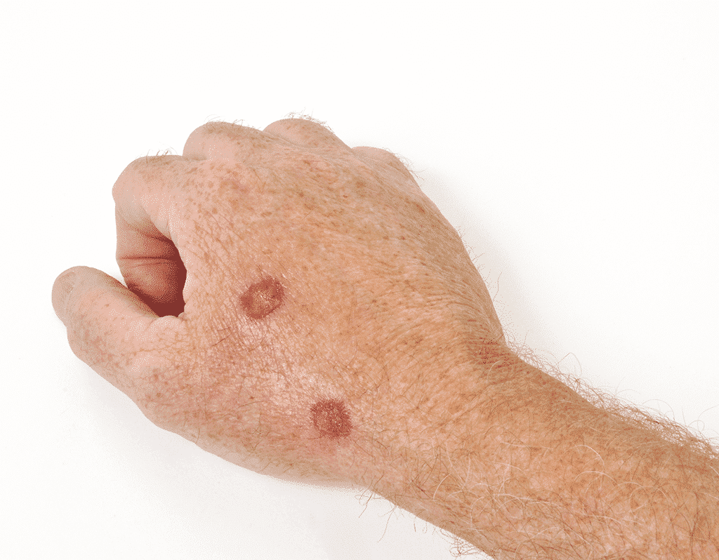 The Skin Cancer and Cosmetic Surgery Center of NJ (SCCSNJ)