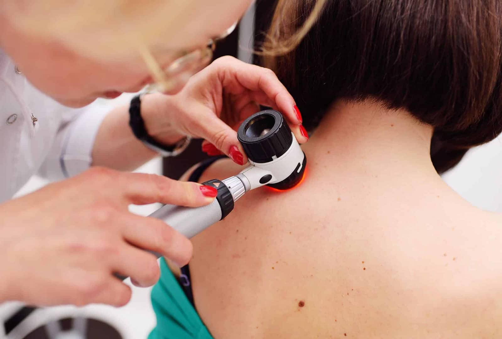Doctor inspecting patient's skin for melanoma diagnosis