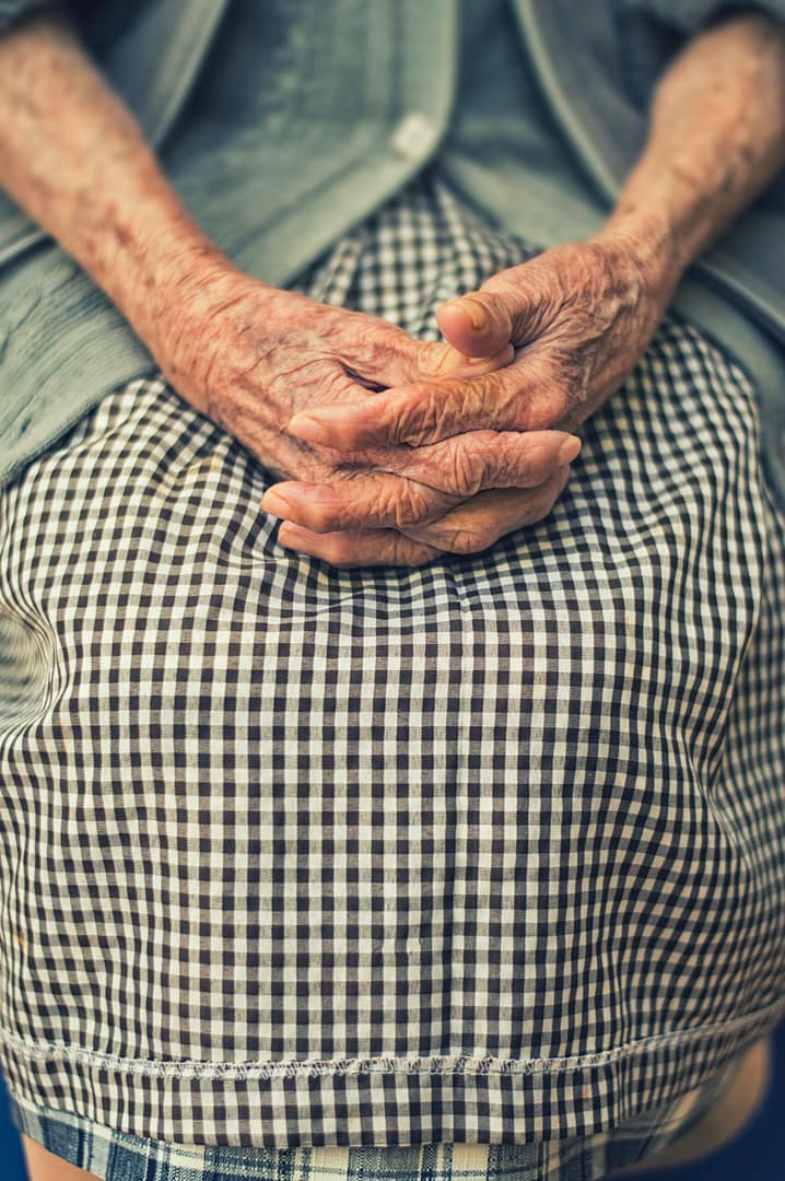 Liver spots on the hands of an older woman